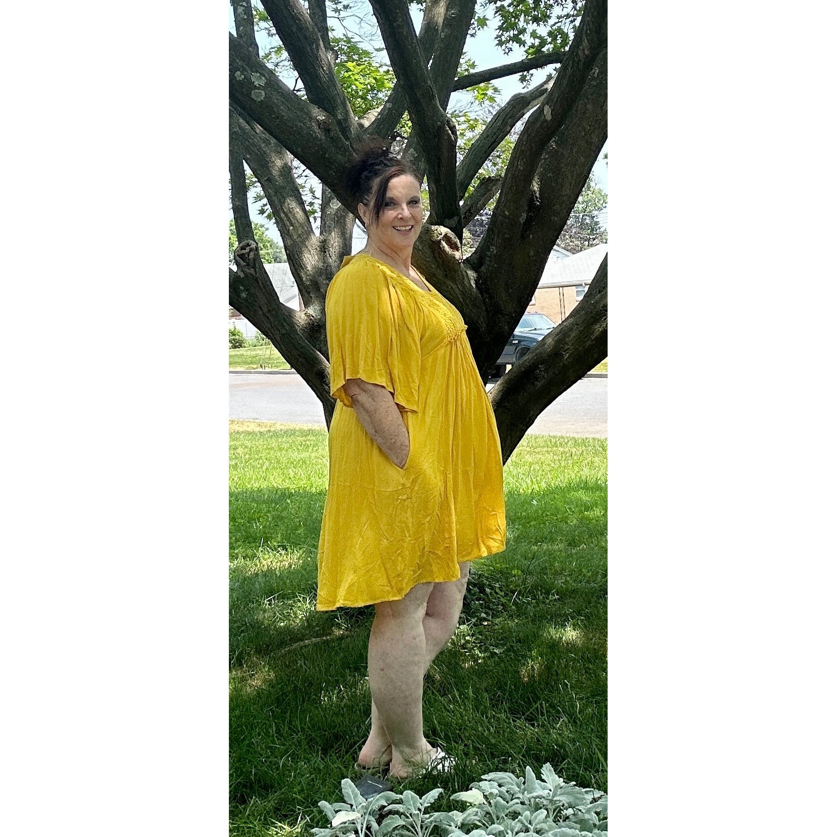 Amy Golden Yellow Lace Dress - Rhapsody and Renascence