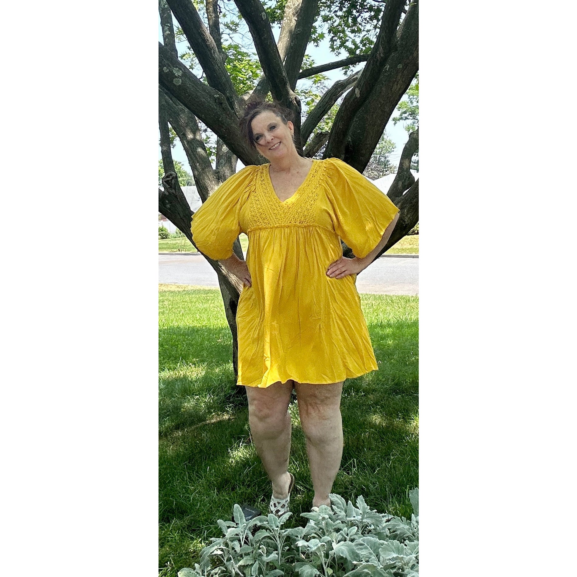 Amy Golden Yellow Lace Dress - Rhapsody and Renascence